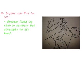 4. Supine and Pull to 
Sit: 
- Greater Head lag 
than in newborn but 
attempts to lift 
head. 
 