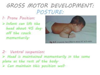 GROSS MOTOR DEVELOPMENT: 
POSTURE: 
1. Prone Position: 
 Infant can lift the 
head about 45 deg. 
off the couch 
momentarily. 
2. Ventral suspension: 
 Head is maintained momentarily in the same 
plane as the rest of the body. 
 Can maintain this position well. 
 
