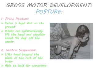 GROSS MOTOR DEVELOPMENT: 
POSTURE: 
1. Prone Position: 
 Pelvis is kept flat on the 
ground. 
 Infant can symmetrically 
lift the head and shoulder 
about 45 deg. off the 
couch. 
2. Ventral Suspension: 
 Lifts head beyond the 
plane of the rest of the 
body. 
 Able to hold for sometime. 
 