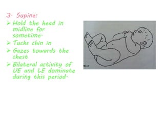 3. Supine: 
 Hold the head in 
midline for 
sometime. 
 Tucks chin in 
 Gazes towards the 
chest 
 Bilateral activity of 
UE and LE dominate 
during this period. 
 