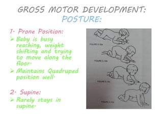 GROSS MOTOR DEVELOPMENT: 
POSTURE: 
1. Prone Position: 
 Baby is busy 
reaching, weight 
shifting and trying 
to move along the 
floor. 
 Maintains Quadruped 
position well. 
2. Supine: 
 Rarely stays in 
supine. 
 