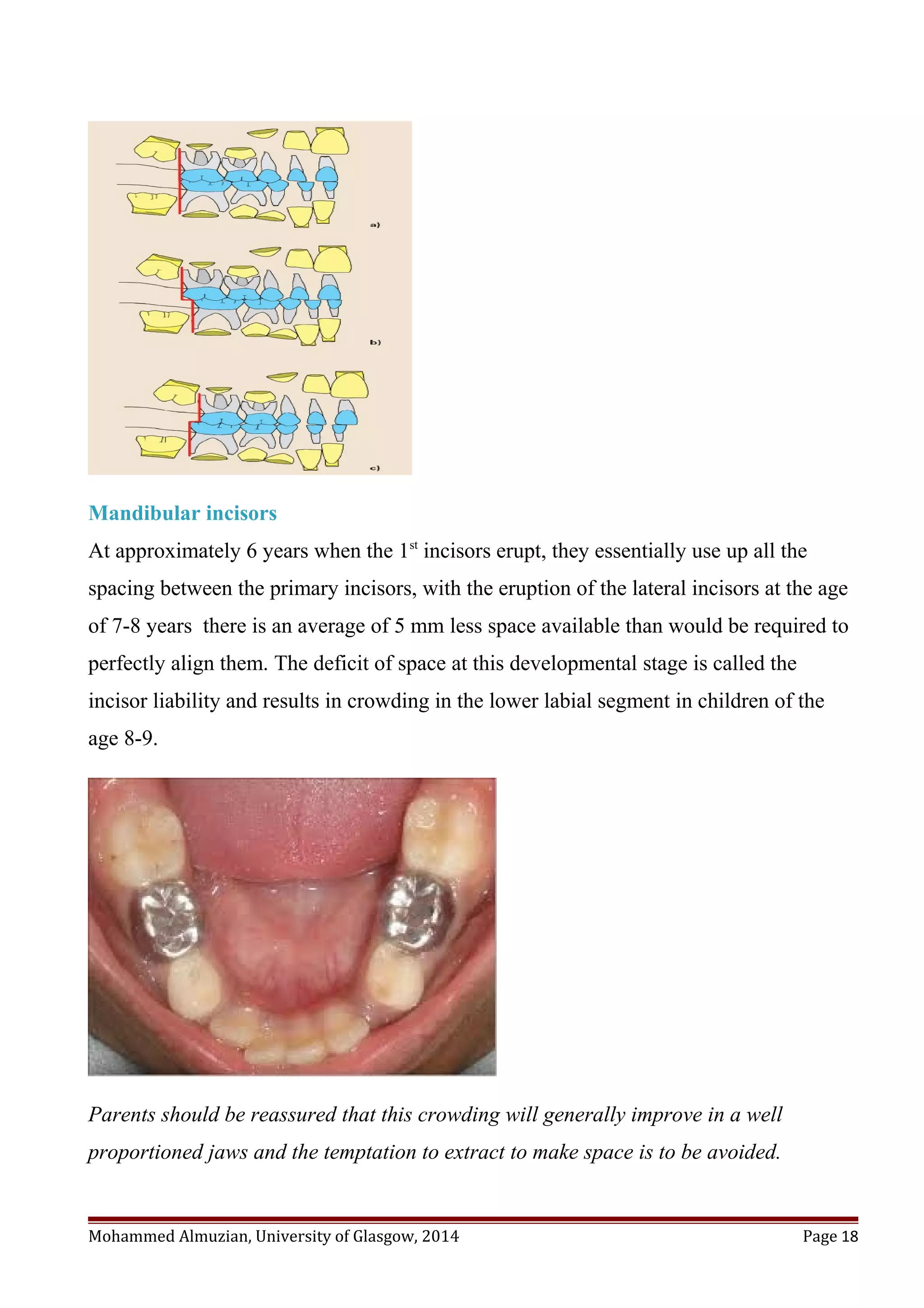 Mandibular incisors
At approximately 6 years when the 1st
incisors erupt, they essentially use up all the
spacing between the primary incisors, with the eruption of the lateral incisors at the age
of 7-8 years there is an average of 5 mm less space available than would be required to
perfectly align them. The deficit of space at this developmental stage is called the
incisor liability and results in crowding in the lower labial segment in children of the
age 8-9.
Parents should be reassured that this crowding will generally improve in a well
proportioned jaws and the temptation to extract to make space is to be avoided.
Mohammed Almuzian, University of Glasgow, 2014 Page 18
 