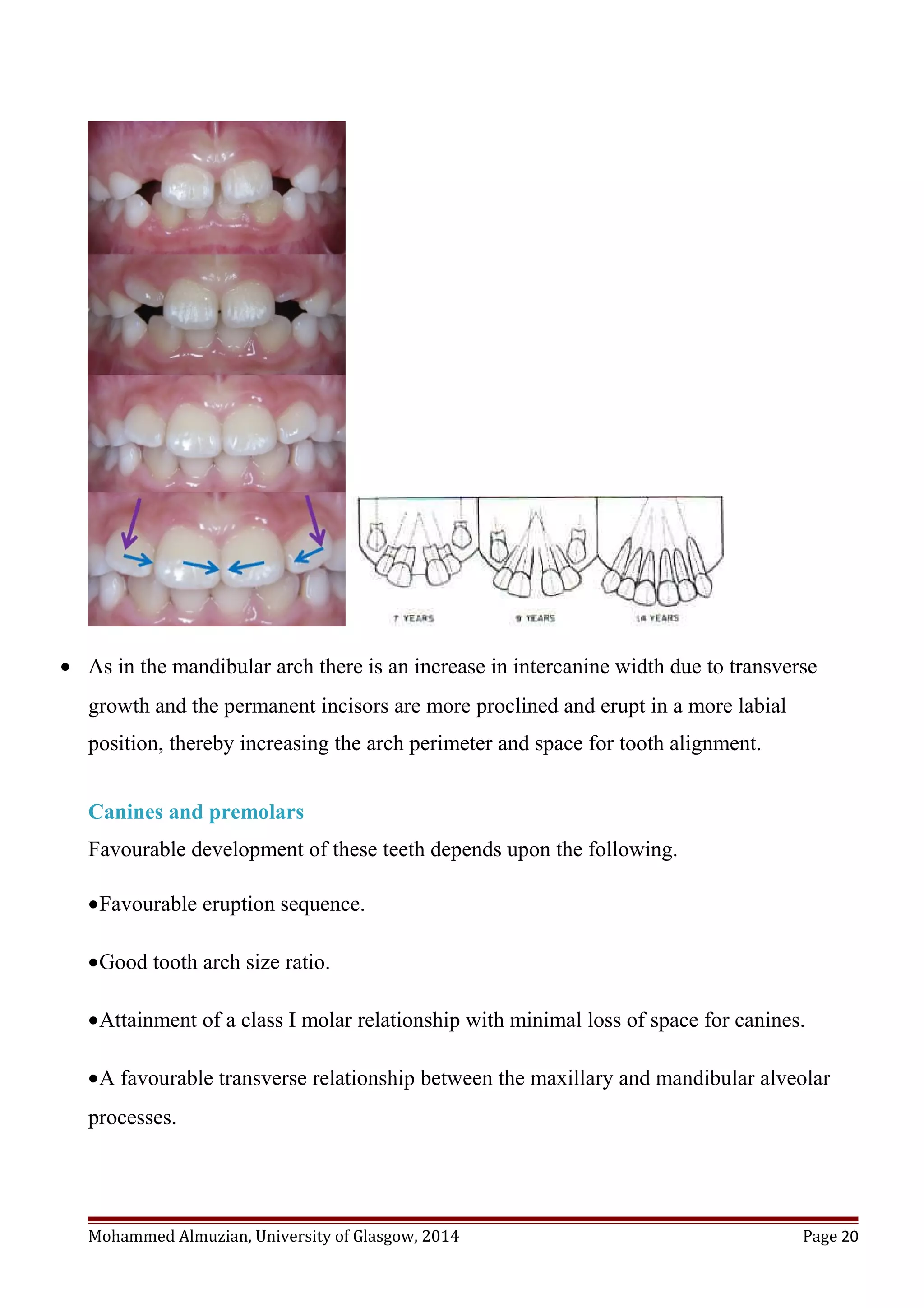 • As in the mandibular arch there is an increase in intercanine width due to transverse
growth and the permanent incisors are more proclined and erupt in a more labial
position, thereby increasing the arch perimeter and space for tooth alignment.
Canines and premolars
Favourable development of these teeth depends upon the following.
•Favourable eruption sequence.
•Good tooth arch size ratio.
•Attainment of a class I molar relationship with minimal loss of space for canines.
•A favourable transverse relationship between the maxillary and mandibular alveolar
processes.
Mohammed Almuzian, University of Glasgow, 2014 Page 20
 