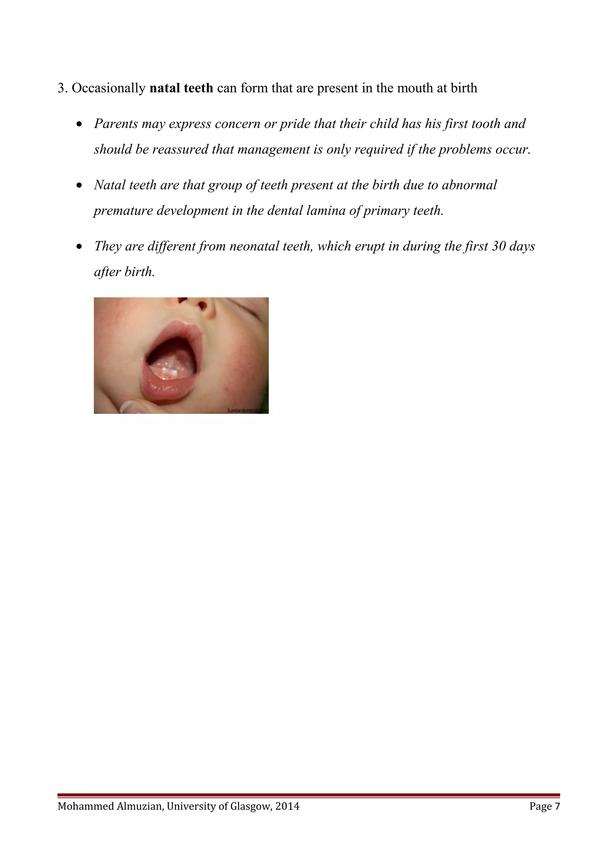 3. Occasionally natal teeth can form that are present in the mouth at birth
• Parents may express concern or pride that their child has his first tooth and
should be reassured that management is only required if the problems occur.
• Natal teeth are that group of teeth present at the birth due to abnormal
premature development in the dental lamina of primary teeth.
• They are different from neonatal teeth, which erupt in during the first 30 days
after birth.
Mohammed Almuzian, University of Glasgow, 2014 Page 7
 