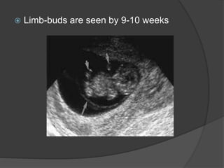  Limb-buds are seen by 9-10 weeks
 