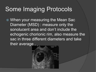 Some Imaging Protocols
 When your measuring the Mean Sac
Diameter (MSD) : measure only the
sonolucent area and don’t include the
echogenic chorionic rim, also measure the
sac in three different diameters and take
their average .
 