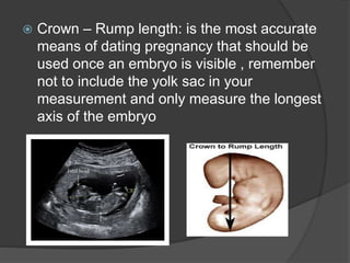  Crown – Rump length: is the most accurate
means of dating pregnancy that should be
used once an embryo is visible , remember
not to include the yolk sac in your
measurement and only measure the longest
axis of the embryo
 