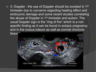  3- Doppler : the use of Doppler should be avoided in 1st
trimester due to concerns regarding heating effect and
embryonic damage and some recent studies correlating
the abuse of Doppler in 1st trimester and autism. The
usual Doppler sign is the “ring of fire” which is a non
specific finding as it can be found in ectopic pregnancy
and in the corpus luteum as well as normal chorionic
tissue
 