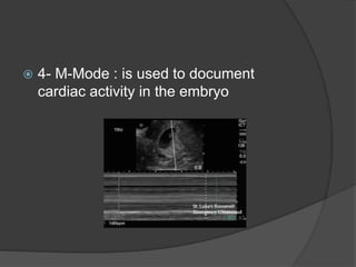  4- M-Mode : is used to document
cardiac activity in the embryo
 