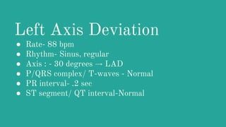 NORMAL Electrocardiography for Medical and Nursing Students | PPTX