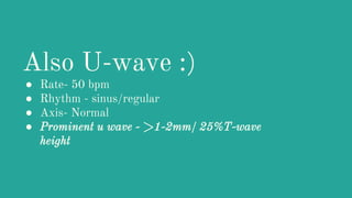 NORMAL Electrocardiography for Medical and Nursing Students | PPTX