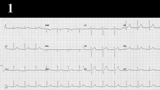NORMAL Electrocardiography for Medical and Nursing Students | PPTX