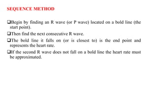 Two Consecutive R Waves NORMAL Electrocardiogram, ECK/EKG PPT.... | PPTX