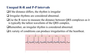 NORMAL Electrocardiogram, ECK/EKG PPT.... | PPTX