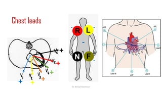 Normal and abnormal ECG pdf 123456789000 | PDF