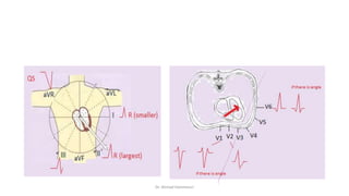 Normal and abnormal ECG pdf 123456789000 | PDF