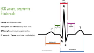 Normal and abnormal ECG pdf 123456789000 | PDF