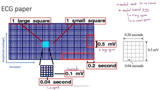 Normal and abnormal ECG pdf 123456789000 | PDF