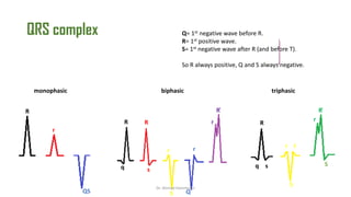 Normal and abnormal ECG pdf 123456789000 | PDF