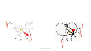 Normal and abnormal ECG pdf 123456789000 | PDF