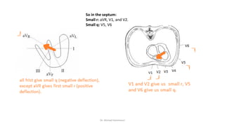 Normal and abnormal ECG pdf 123456789000 | PDF
