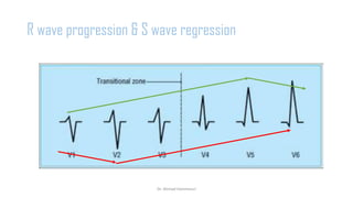 Normal and abnormal ECG pdf 123456789000 | PDF
