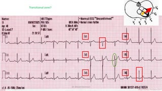 Normal and abnormal ECG pdf 123456789000 | PDF