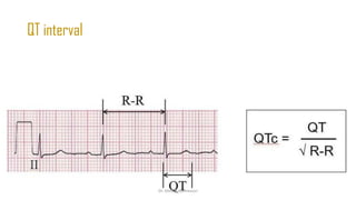 Normal and abnormal ECG pdf 123456789000 | PDF