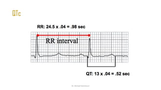 Normal and abnormal ECG pdf 123456789000 | PDF