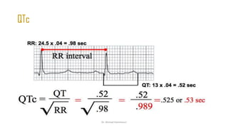Normal and abnormal ECG pdf 123456789000 | PDF