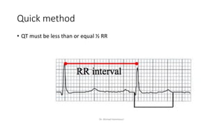 Normal and abnormal ECG pdf 123456789000 | PDF