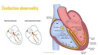 Normal and abnormal ECG pdf 123456789000 | PDF