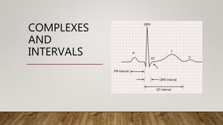 12 LEAD NORMAL ELECTROCARDIOGRAM | PPTX