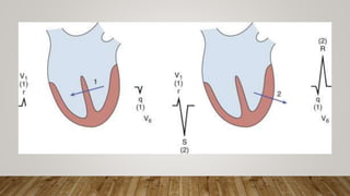 12 LEAD NORMAL ELECTROCARDIOGRAM | PPTX