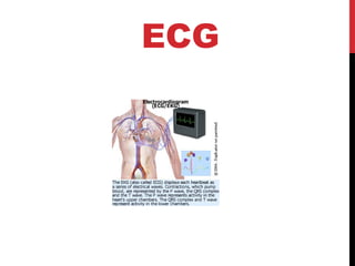ECG
 