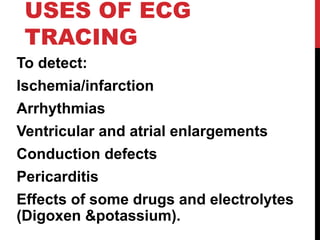 USES OF ECG
TRACING
To detect:
Ischemia/infarction
Arrhythmias
Ventricular and atrial enlargements
Conduction defects
Pericarditis
Effects of some drugs and electrolytes
(Digoxen &potassium).
 