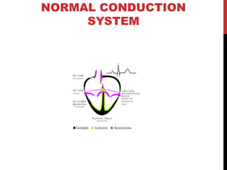 NORMAL CONDUCTION
SYSTEM
 