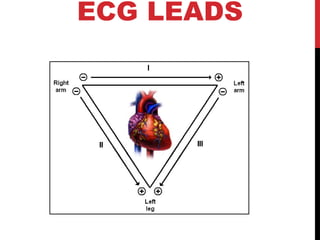 ECG LEADS
Standard Limb Leads
 