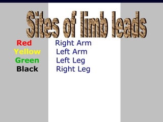 Red
Yellow
Green
Black
Right Arm
Left Arm
Left Leg
Right Leg
 