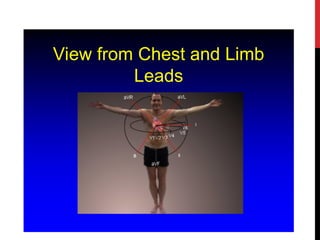 View from Chest and Limb
Leads
 