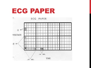 ECG PAPER
 