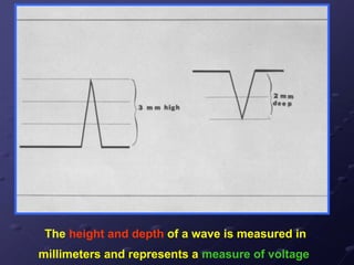 The height and depth of a wave is measured in
millimeters and represents a measure of voltage
 