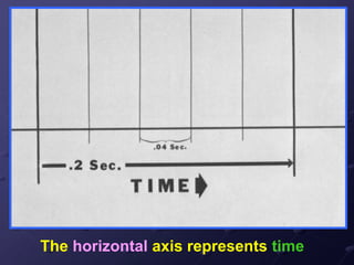 The horizontal axis represents time
 