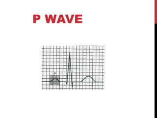 P WAVE
 