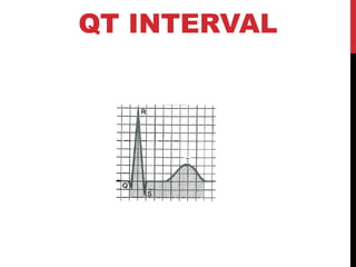 QT INTERVAL
 