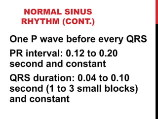 NORMAL SINUS
RHYTHM (CONT.)
One P wave before every QRS
PR interval: 0.12 to 0.20
second and constant
QRS duration: 0.04 to 0.10
second (1 to 3 small blocks)
and constant
 