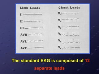 The standard EKG is composed of 12
separate leads
 