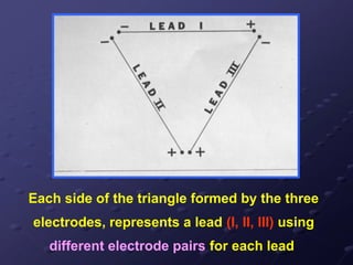 Each side of the triangle formed by the three
electrodes, represents a lead (I, II, III) using
different electrode pairs for each lead
 
