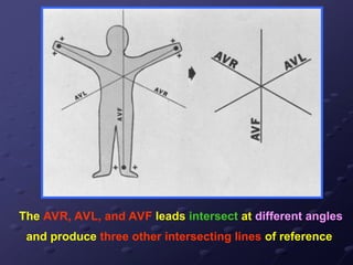 The AVR, AVL, and AVF leads intersect at different angles
and produce three other intersecting lines of reference
 