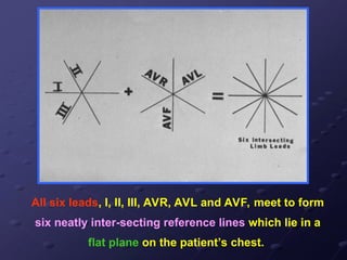 All six leads, I, II, III, AVR, AVL and AVF, meet to form
six neatly inter-secting reference lines which lie in a
flat plane on the patient’s chest.
 